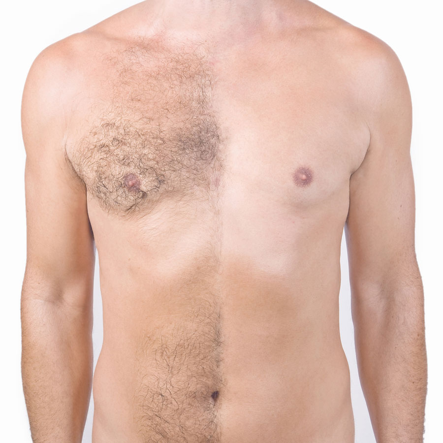 Intome Hair Removal Powder - Bild 2